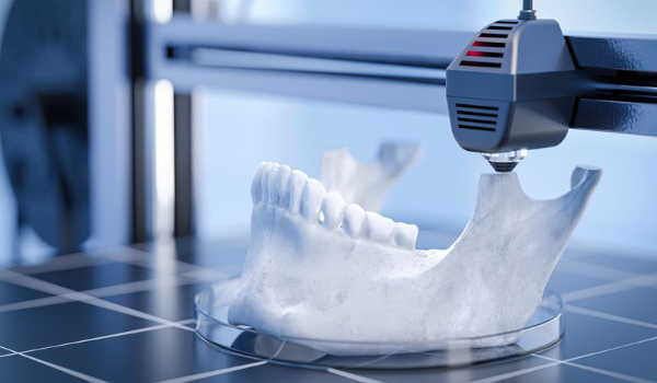 Công nghệ in 3D được ứng dụng để sản xuất răng giả/xương nhân tạo